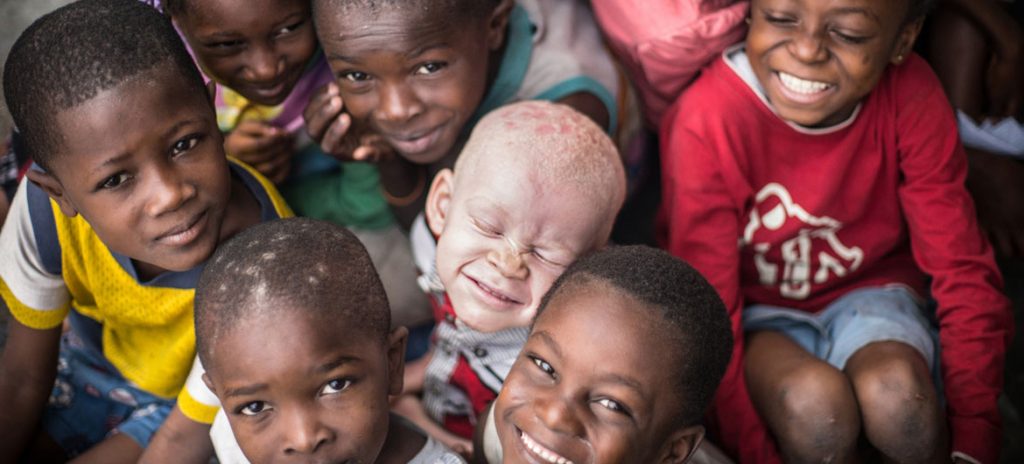 O albinismo é uma condição rara, não contagiosa e genética presente no nascimento. É encontrada em ambos os gêneros, independentemente de etnia, em todos os países