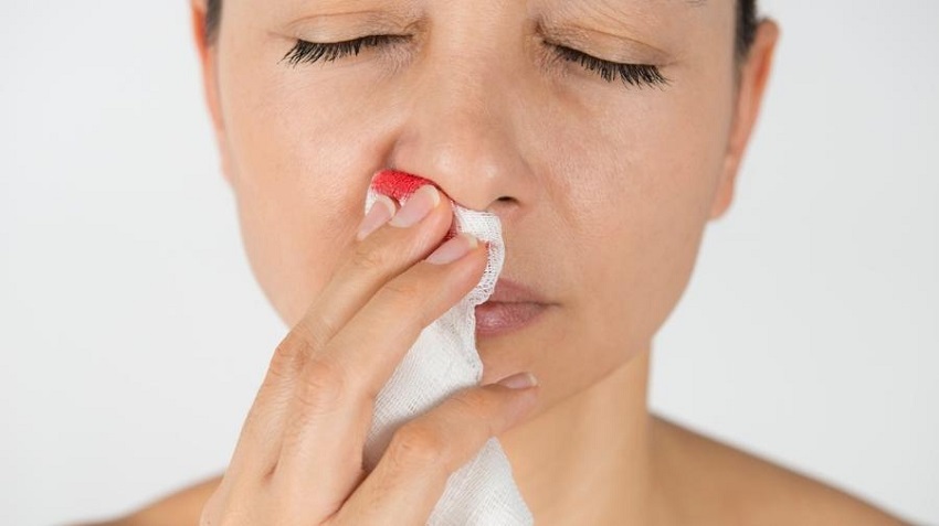 Sangramento nasal nem sempre tem relação com tempo seco