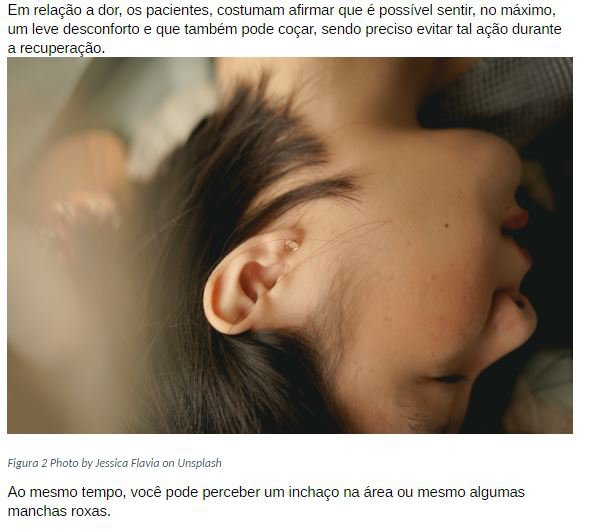 Como recuperar orelha rasgada (Foto: Callie Morgan on Unsplash) Como recuperar orelha rasgada (Foto: Callie Morgan on Unsplash)