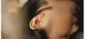 Como recuperar orelha rasgada