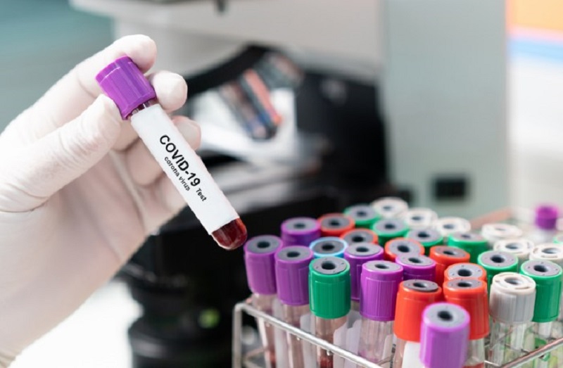 A medida visa diminuir aglomeração de pessoas em hospitais