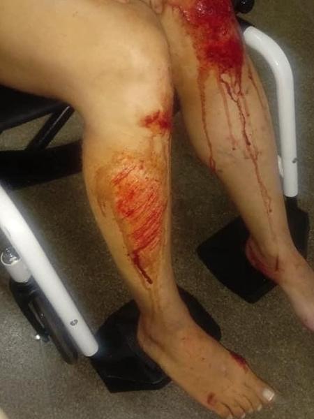 Mulher foi vítima de tentativa de estupro