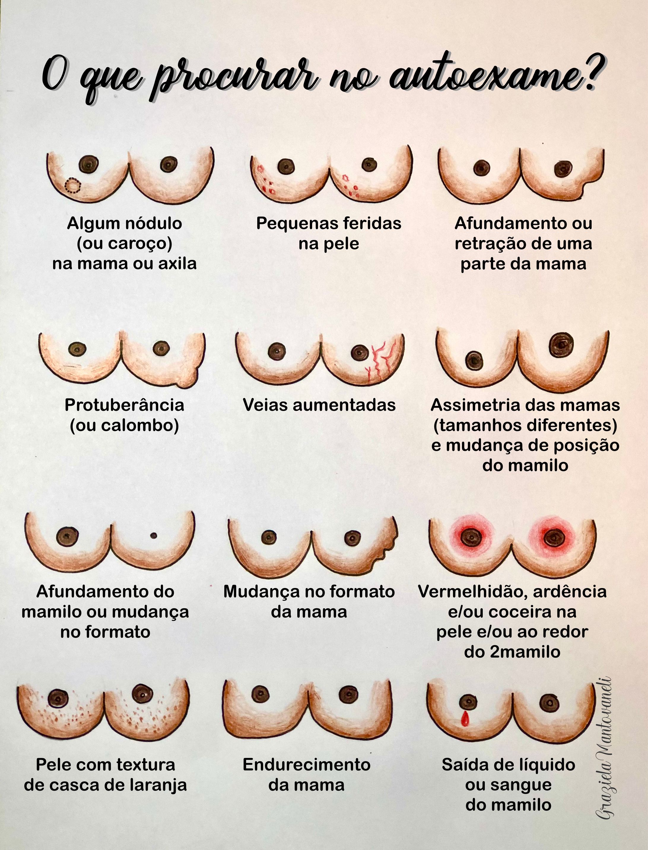 Sinais de câncer de mama