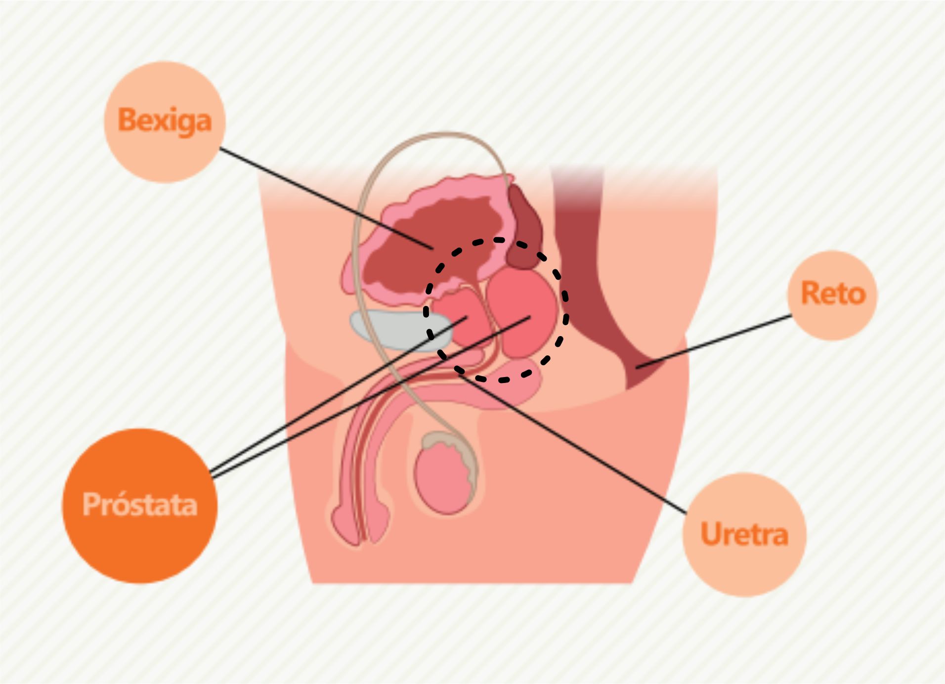 A localização da próstata