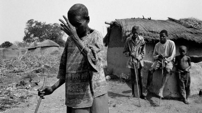 Essa foto, tirada nos anos 1970, retrata três vítimas da "cegueira dos rios" num povoado da África Central