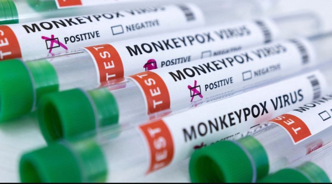 Foto ilustrativa mostra tubos de ensaio rotulados como "vírus da varíola dos macacos positivo e negativo"