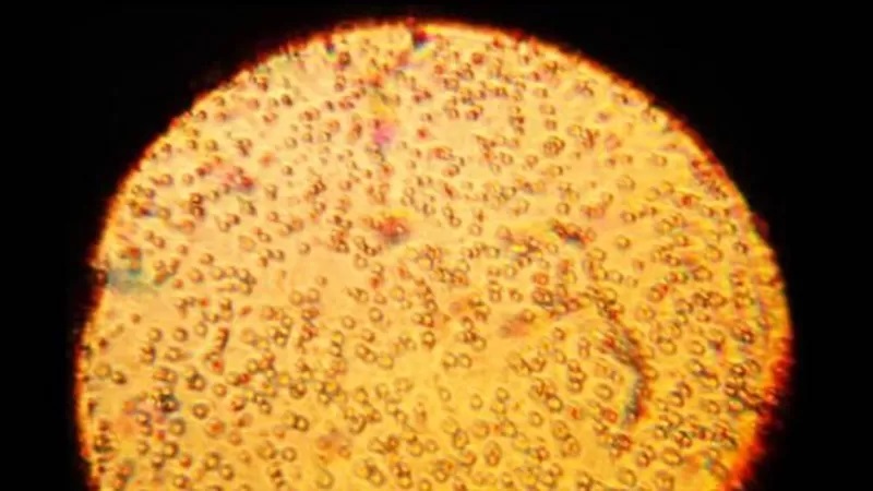 Imagem microscópica de uma amostra de leite materno humano