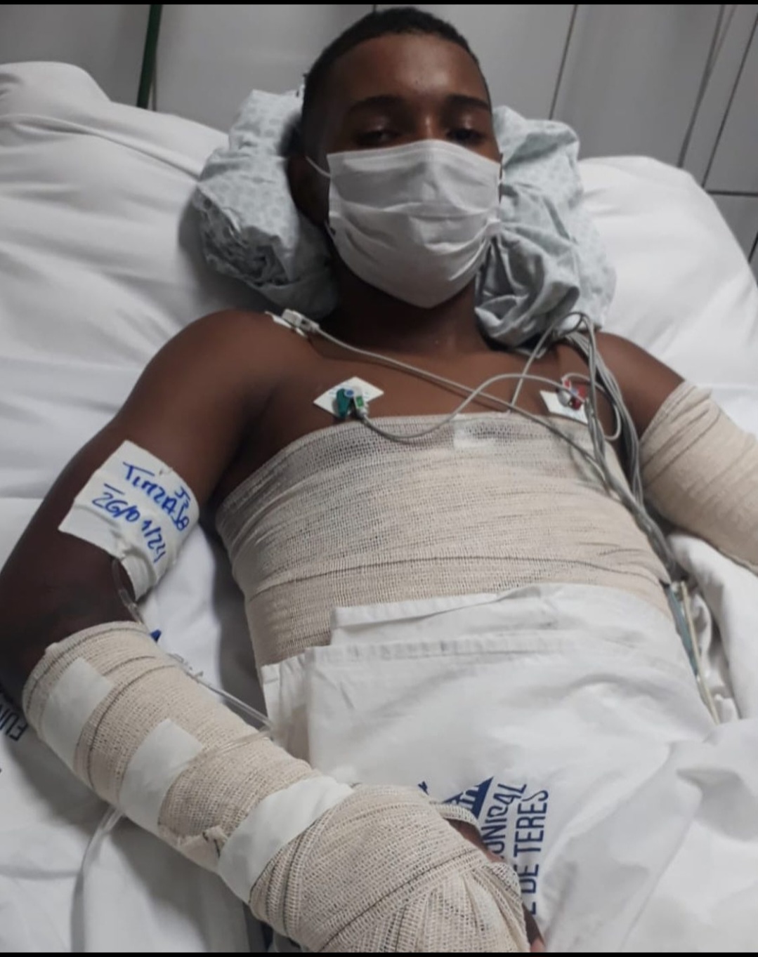 Juvenilson da Costa Carvalho no hospital