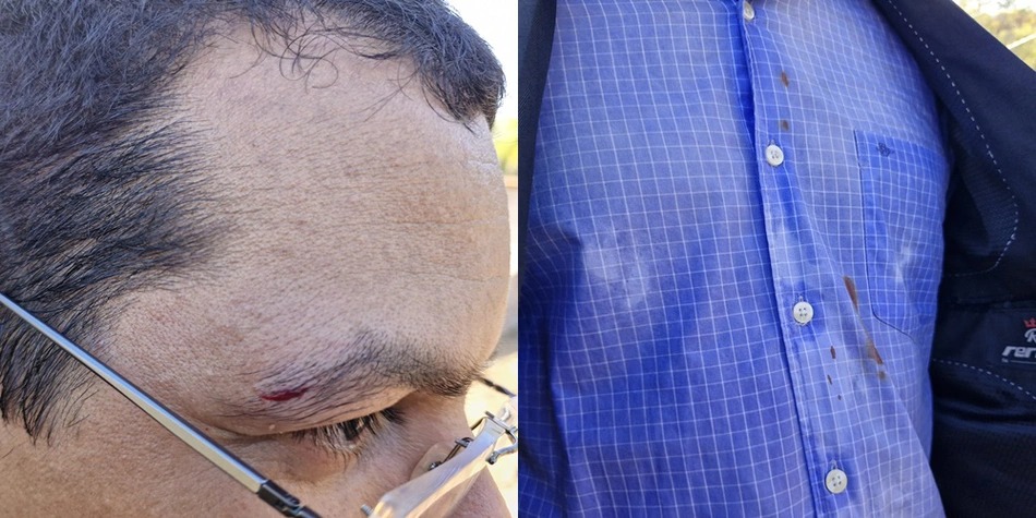 Jornalista da TV Meio é agredido durante operação do DENARC em Teresina
