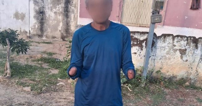 Homem que teve mãos decepadas por suspeita de furto é preso pela terceira vez em Campo Maior